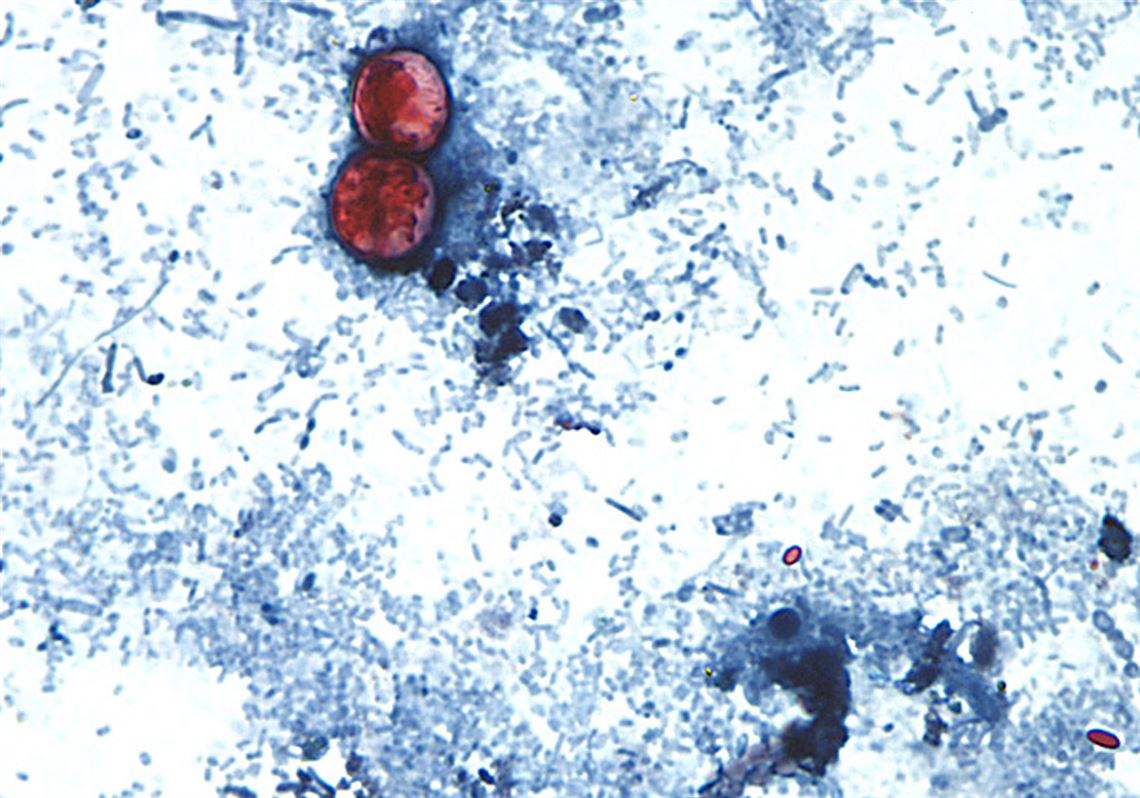 As Mich. and Ohio see influx of a diarrhea-causing infection, Pa. remains at normal levels for now